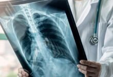 Can lung cancer be prevented using a drug?