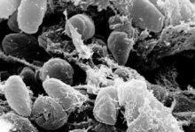 Diseases that changed history