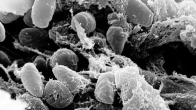 Diseases that changed history
