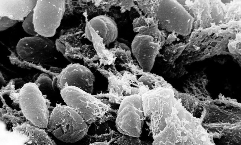Diseases that changed history